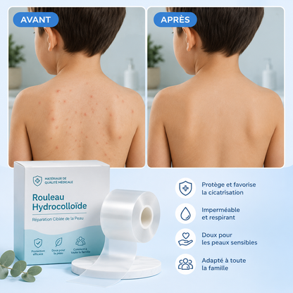 Rouleau Hydrocolloïde Anti-Molluscum Nyvo™
