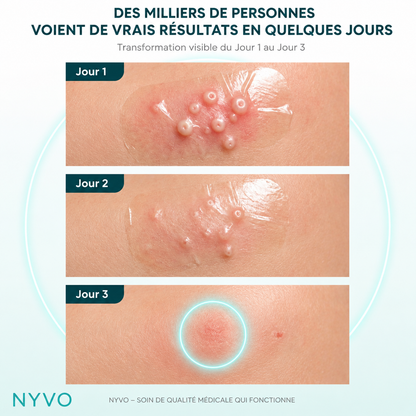 Rouleau Hydrocolloïde Anti-Molluscum Nyvo™